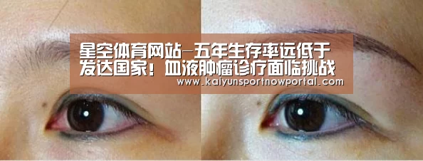 星空体育网站-五年生存率远低于发达国家!血液肿瘤诊疗面临挑战(图3) 星空体育网站-五年生存率远低于发达国家!血液肿瘤诊疗面临挑战(图3)